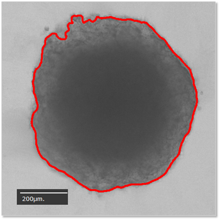 3D細胞培養スフェロイド解析