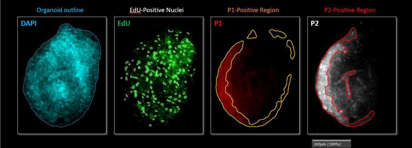 スフェロイド・オルガノイド解析ソフト｜3D細胞培養の自動画像解析 – WiSoftⓇ ATHENA