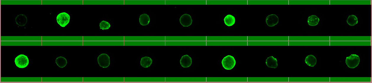 オルガノイド動画解析