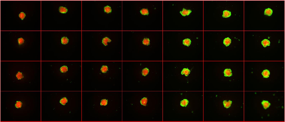 共培養スフェロイド解析2