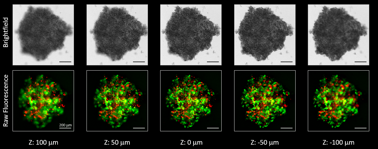 Z-stackデコンボリューション解析